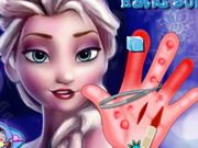 Frozen Hand Surgery